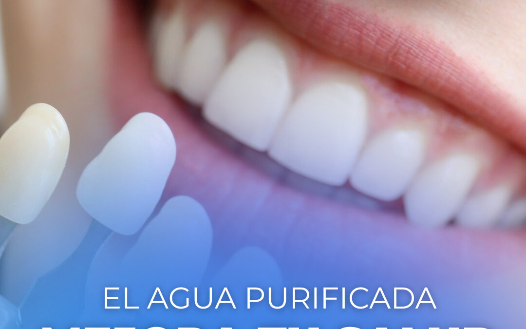 Beneficios del Agua Purificada para la Salud Bucal